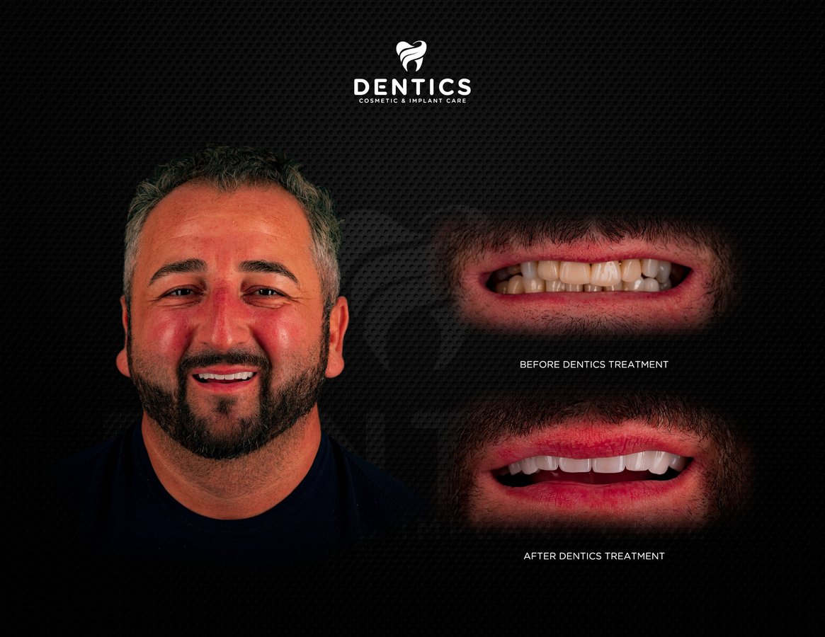 Dentics Cancun - Dentics Cancun