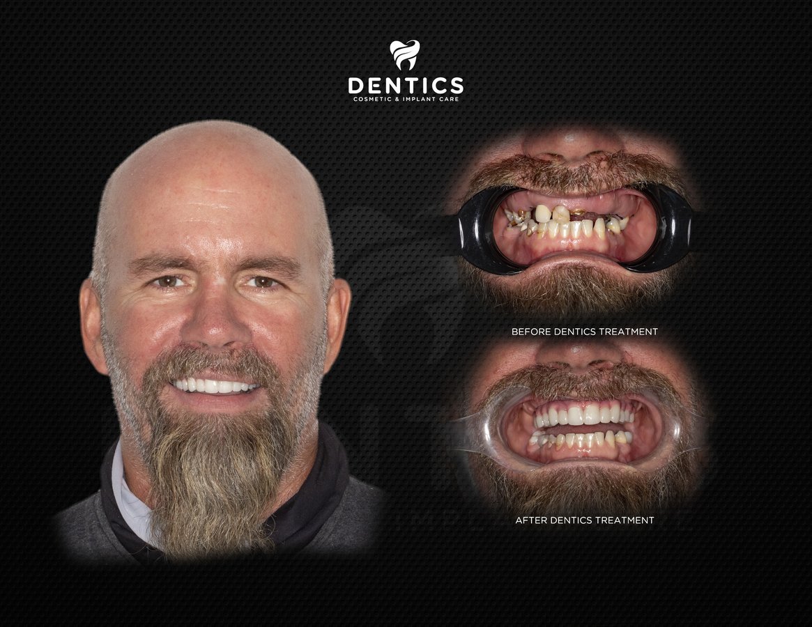 Dentics Cancun - Dentics Cancun