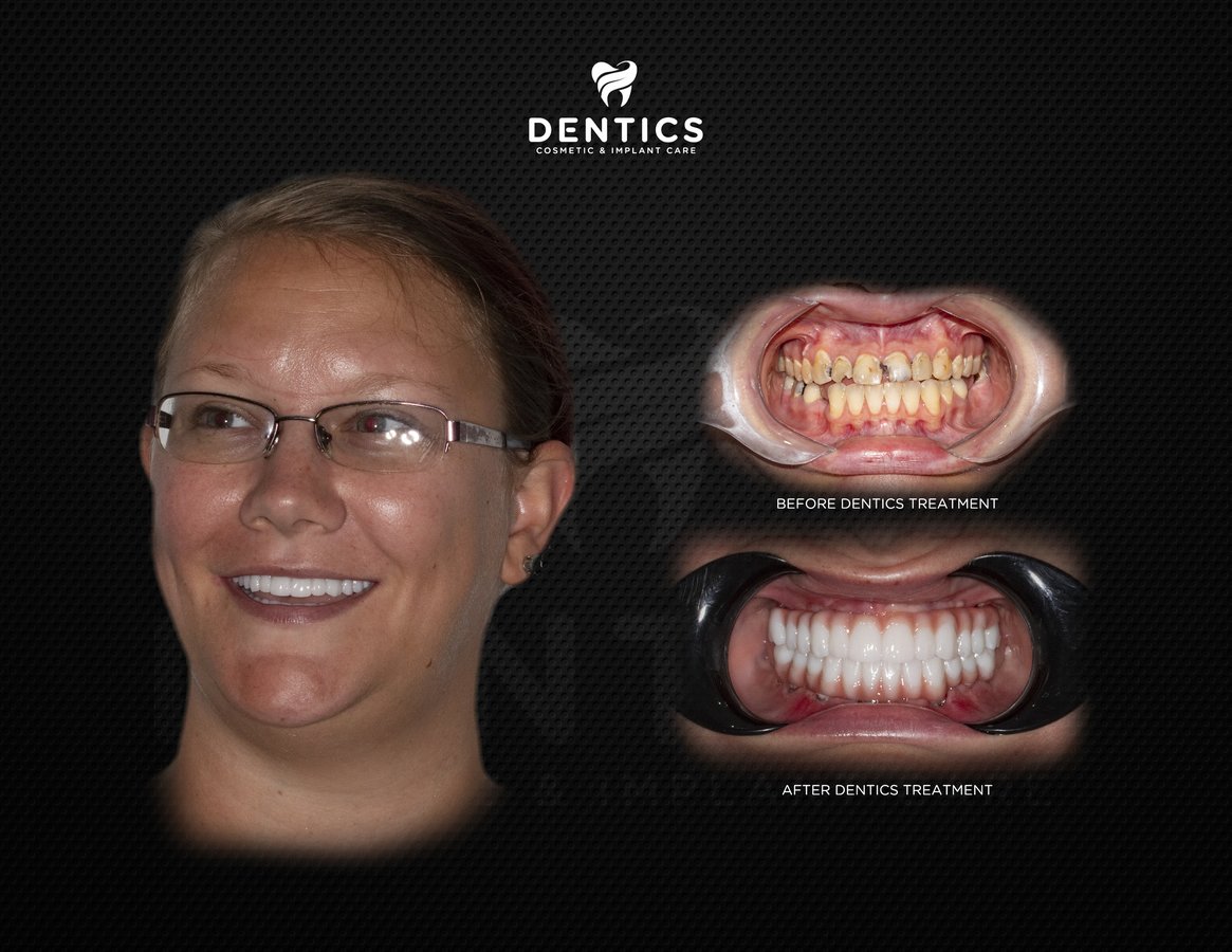 Dentics Cancun - Dentics Cancun