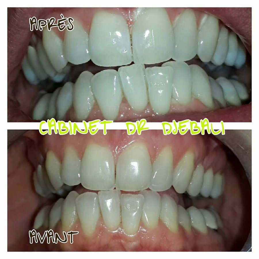 طبيب أسنان الحمامات: الدكتورة هدى دجيبالي - Dentist Hammamet: Dr Houda Djebali