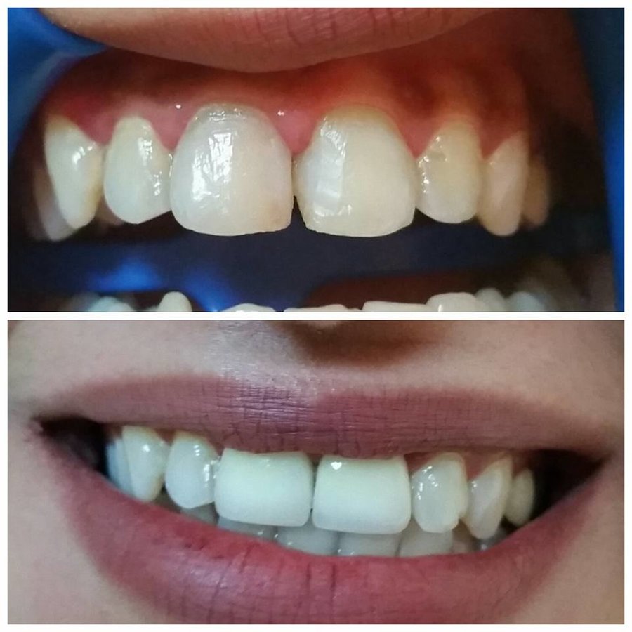 طبيب أسنان الحمامات: الدكتورة هدى دجيبالي - Dentist Hammamet: Dr Houda Djebali