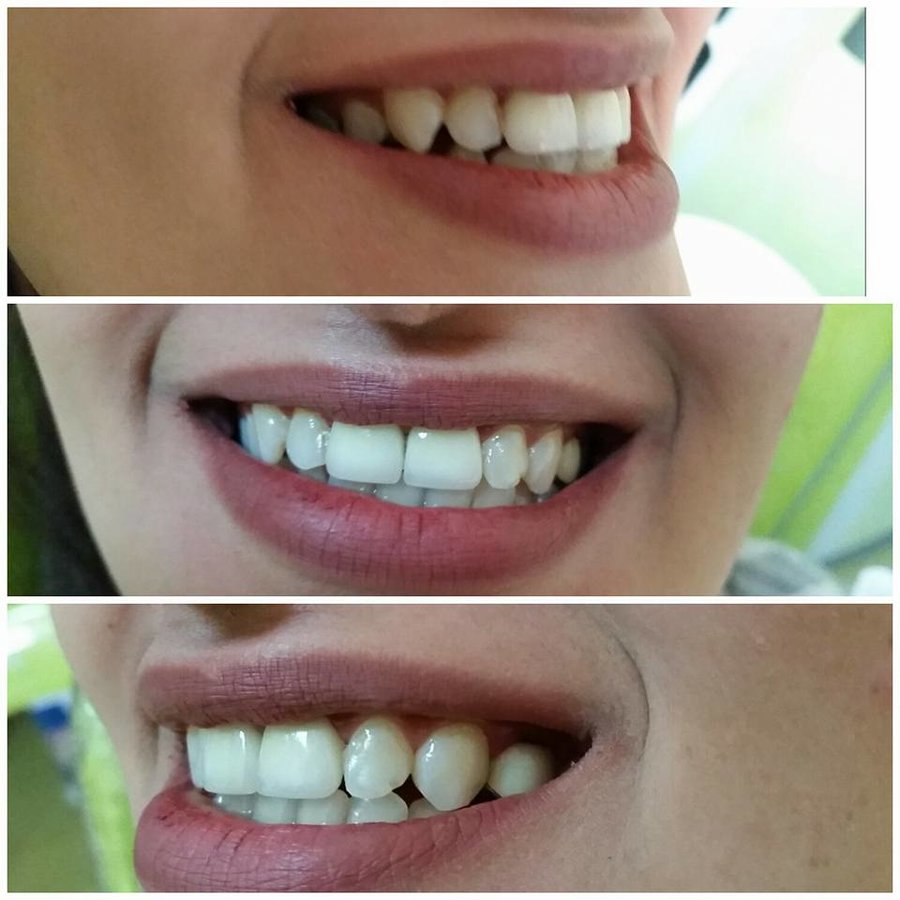 طبيب أسنان الحمامات: الدكتورة هدى دجيبالي - Dentist Hammamet: Dr Houda Djebali