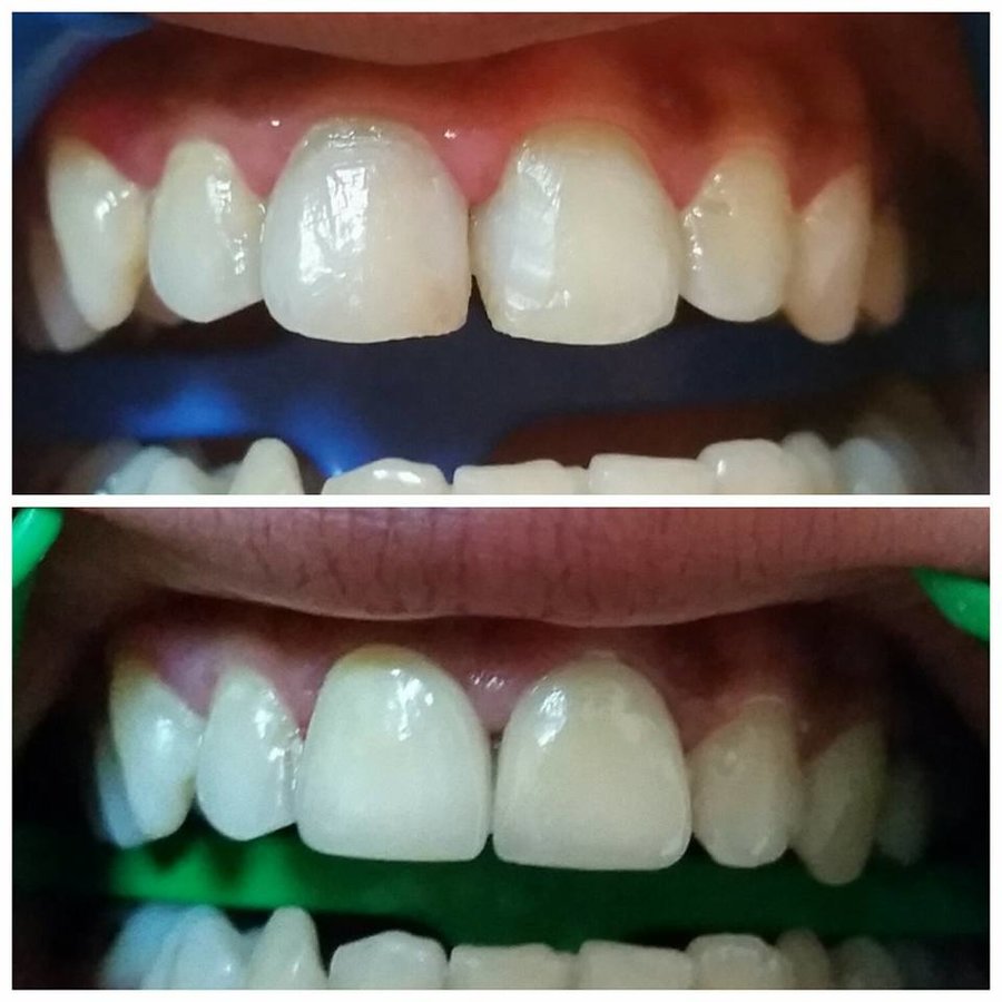 طبيب أسنان الحمامات: الدكتورة هدى دجيبالي - Dentist Hammamet: Dr Houda Djebali