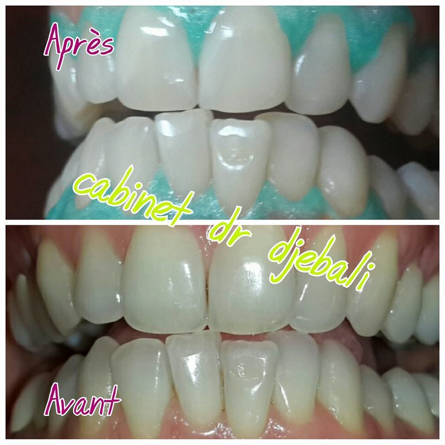 طبيب أسنان الحمامات: الدكتورة هدى دجيبالي - Dentist Hammamet: Dr Houda Djebali