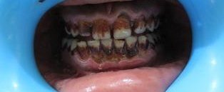Dentist - Multi Speciality Dental Clinic - Dentist - Multi Speciality Dental Clinic
