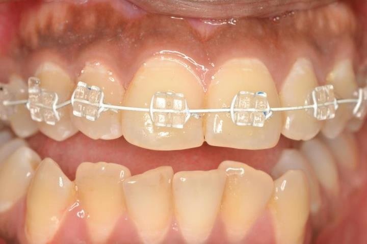 Dentist - Multi Speciality Dental Clinic - Dentist - Multi Speciality Dental Clinic