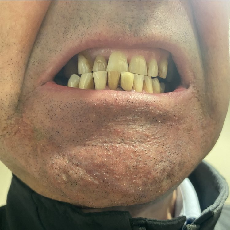 DentMarmaris Dental Clinic & Dental Laboratory - DentMarmaris Dental Clinic & Dental Laboratory