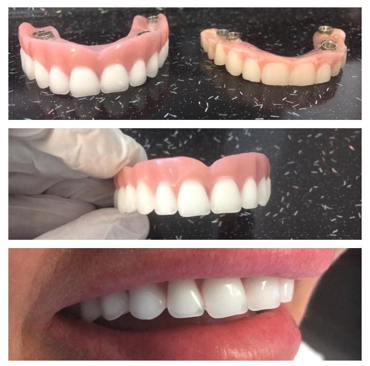 DentMarmaris Dental Clinic & Dental Laboratory - DentMarmaris Dental Clinic & Dental Laboratory