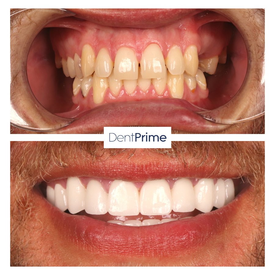 DentPrime Dental Health Clinic - DentPrime Dental Health Clinic