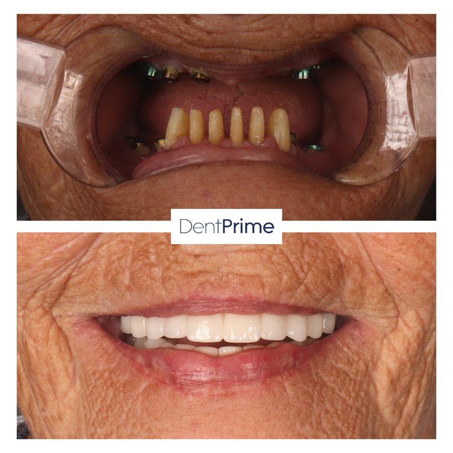 DentPrime Dental Health Clinic - DentPrime Dental Health Clinic