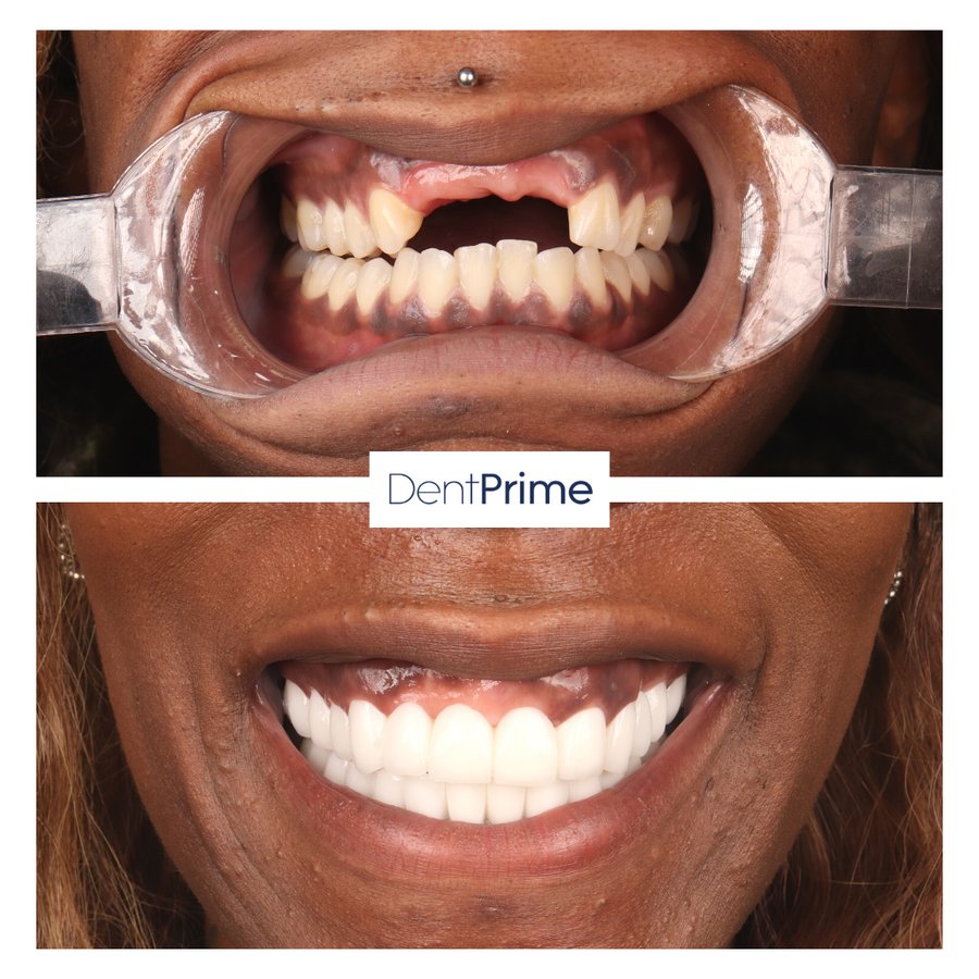 DentPrime Dental Health Clinic - DentPrime Dental Health Clinic