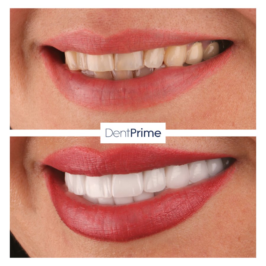 DentPrime Dental Health Clinic - DentPrime Dental Health Clinic