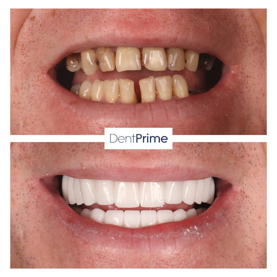DentPrime Dental Health Clinic - DentPrime Dental Health Clinic