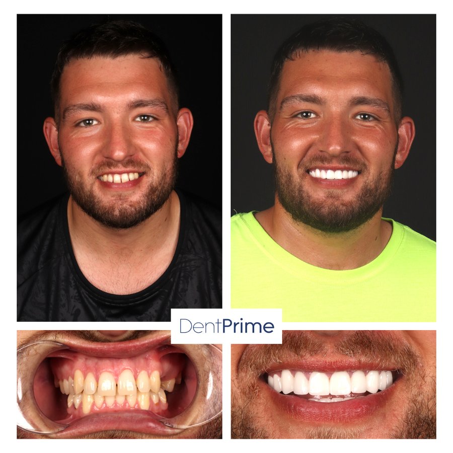 DentPrime Dental Health Clinic - DentPrime Dental Health Clinic