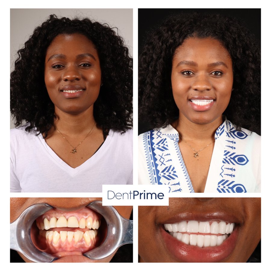 DentPrime Dental Health Clinic - DentPrime Dental Health Clinic