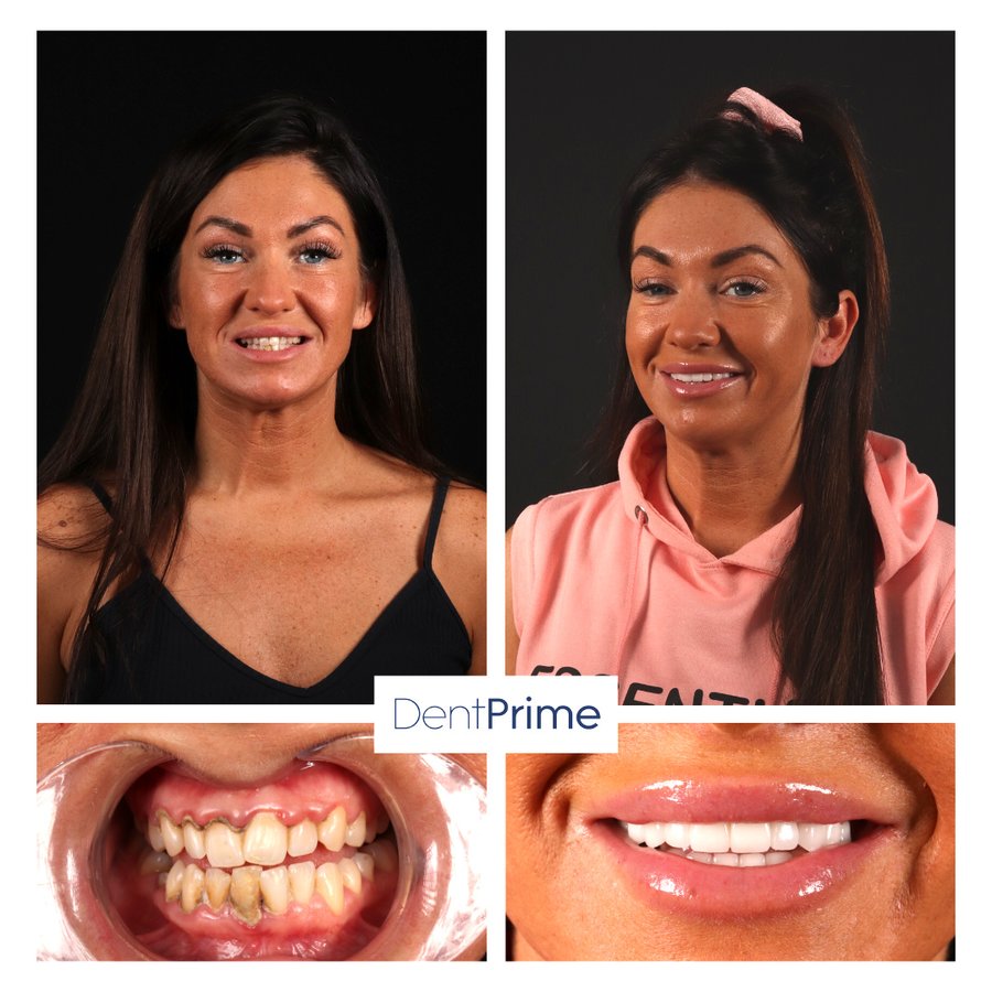 DentPrime Dental Health Clinic - DentPrime Dental Health Clinic