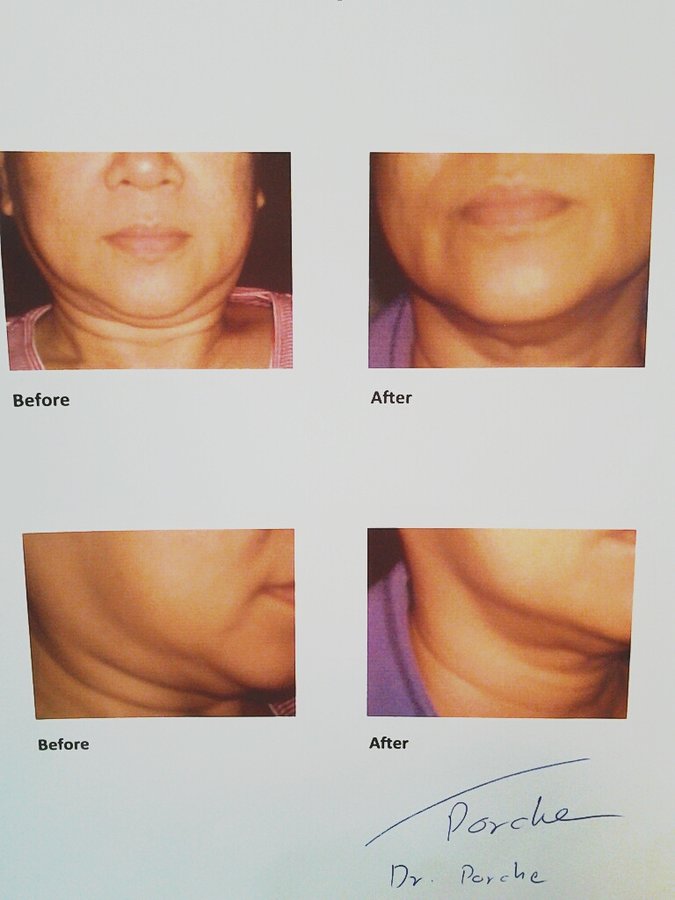 Derma Plus Clinic Phuket - Derma Plus Clinic Phuket