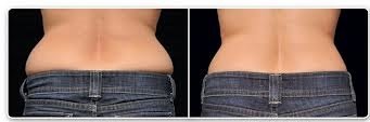 Derma Sculpt Clinic - Bellandur Outer Ring Road - Derma Sculpt Clinic - Bellandur Outer Ring Road