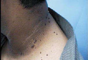 Derma Sculpt Clinic - Bellandur Outer Ring Road - Derma Sculpt Clinic - Bellandur Outer Ring Road