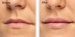 Derma Sculpt Clinic - Bellandur Outer Ring Road - Derma Sculpt Clinic - Bellandur Outer Ring Road