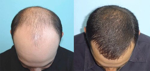 Derma Sculpt Clinic - Bellandur Outer Ring Road - Derma Sculpt Clinic - Bellandur Outer Ring Road