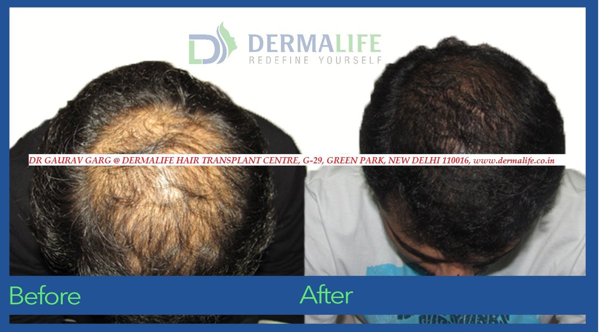 Dermalife Skin and Hair Clinic - Dermalife Skin and Hair Clinic