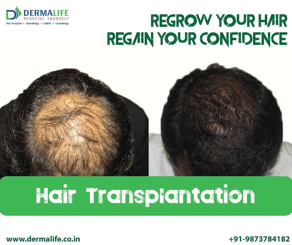 Dermalife Skin and Hair Clinic - Dermalife Skin and Hair Clinic