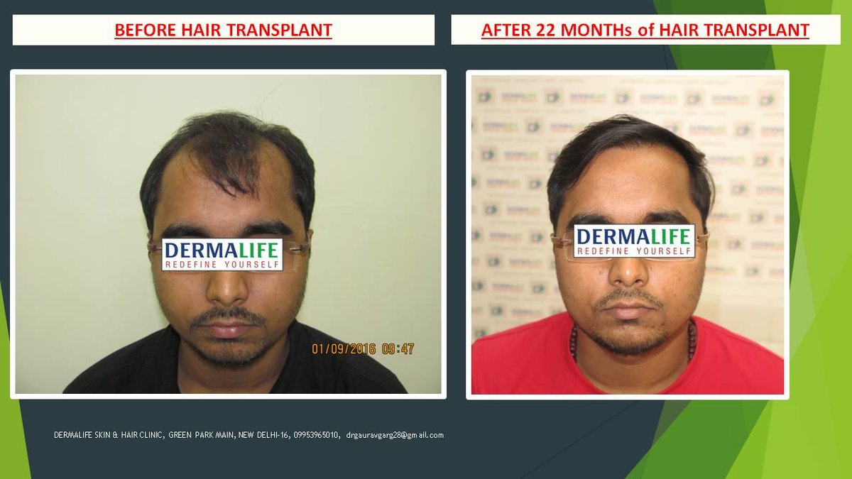 Dermalife Skin and Hair Clinic - Dermalife Skin and Hair Clinic