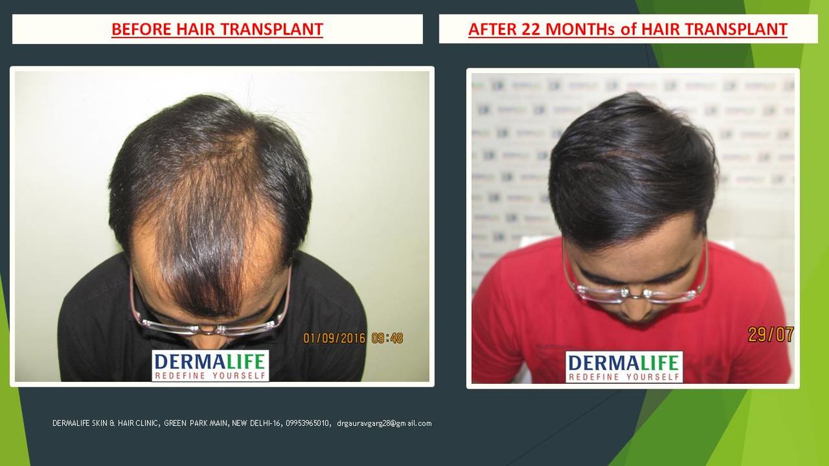 Dermalife Skin and Hair Clinic - Dermalife Skin and Hair Clinic