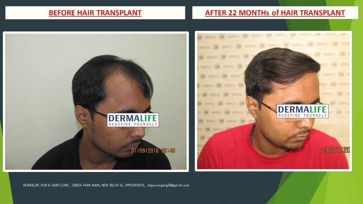 Dermalife Skin and Hair Clinic - Dermalife Skin and Hair Clinic