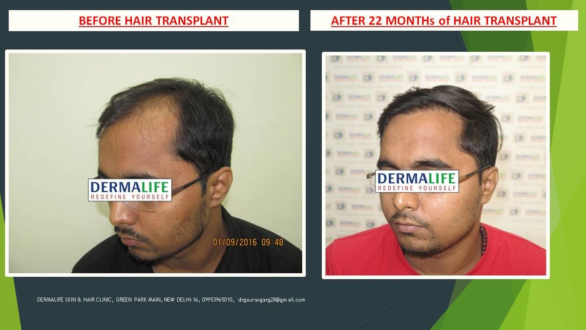 Dermalife Skin and Hair Clinic - Dermalife Skin and Hair Clinic