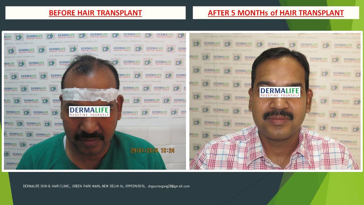 Dermalife Skin and Hair Clinic - Dermalife Skin and Hair Clinic