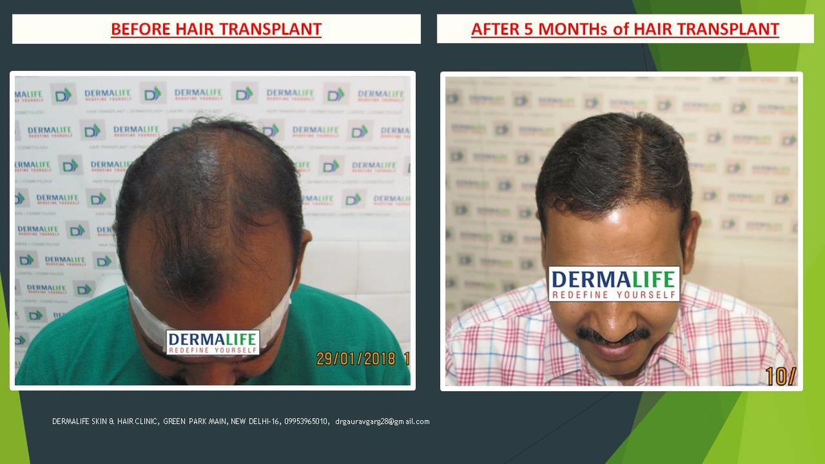 Dermalife Skin and Hair Clinic - Dermalife Skin and Hair Clinic