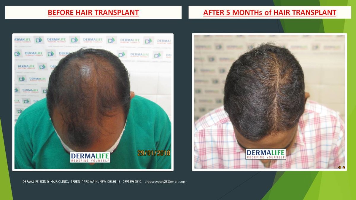 Dermalife Skin and Hair Clinic - Dermalife Skin and Hair Clinic