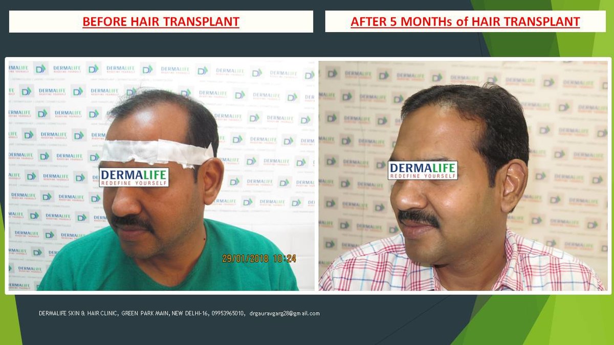 Dermalife Skin and Hair Clinic - Dermalife Skin and Hair Clinic