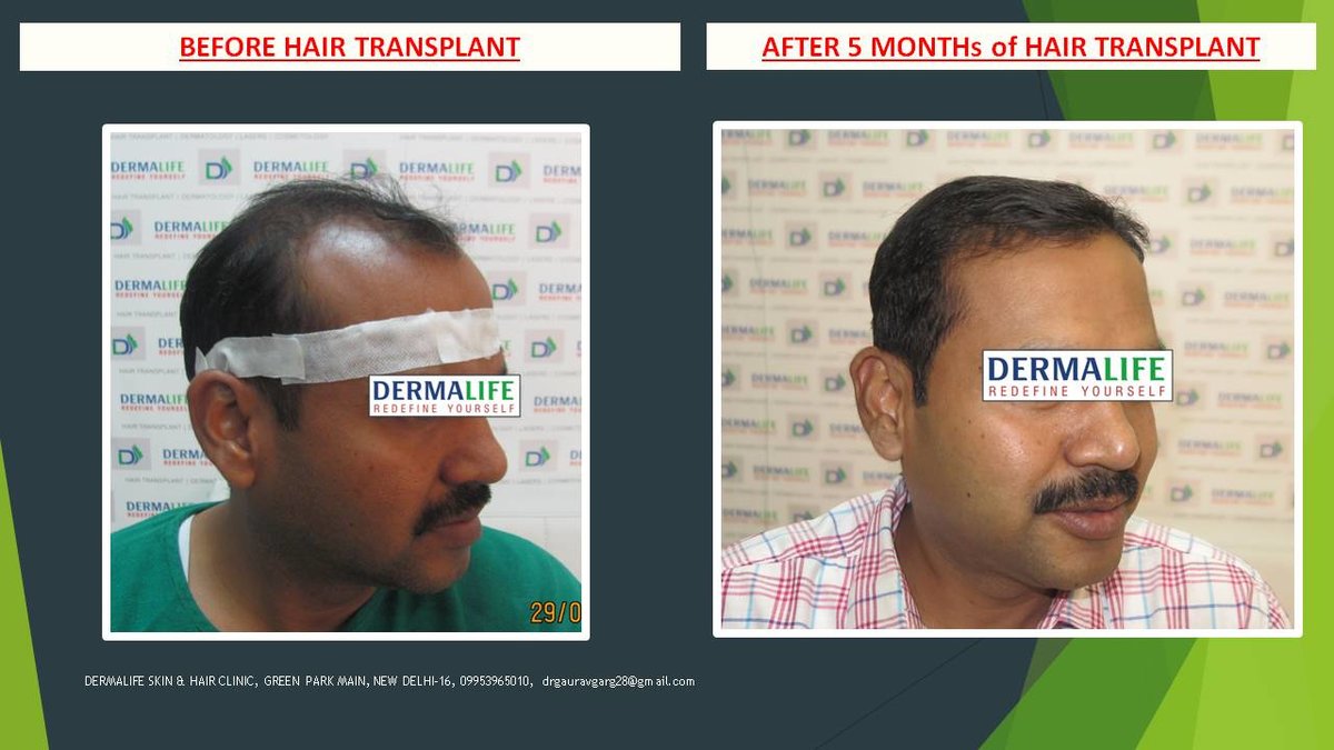 Dermalife Skin and Hair Clinic - Dermalife Skin and Hair Clinic