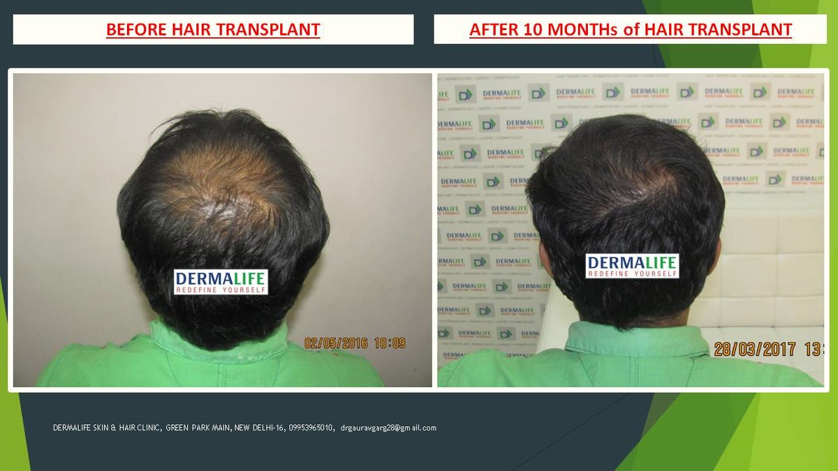 Dermalife Skin and Hair Clinic - Dermalife Skin and Hair Clinic