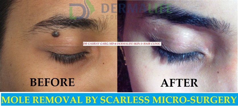 Dermalife Skin and Hair Clinic - Dermalife Skin and Hair Clinic