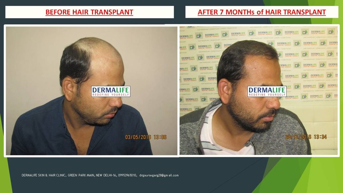 Dermalife Skin and Hair Clinic - Dermalife Skin and Hair Clinic