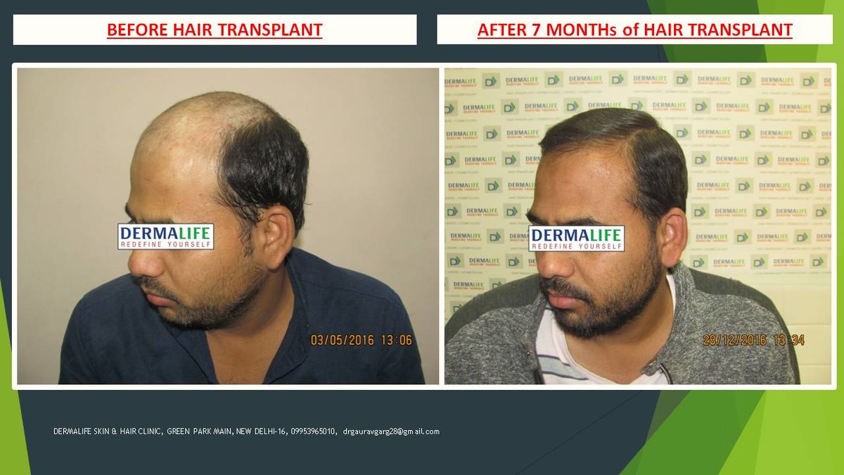 Dermalife Skin and Hair Clinic - Dermalife Skin and Hair Clinic