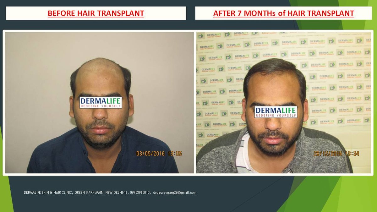 Dermalife Skin and Hair Clinic - Dermalife Skin and Hair Clinic