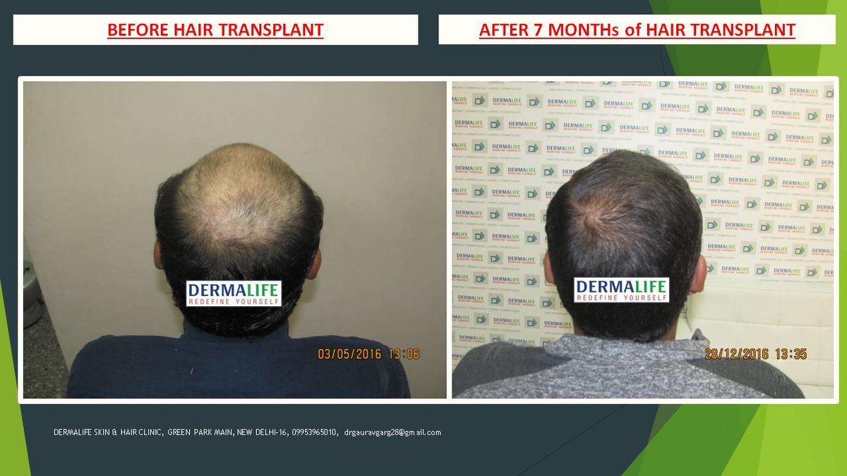 Dermalife Skin and Hair Clinic - Dermalife Skin and Hair Clinic