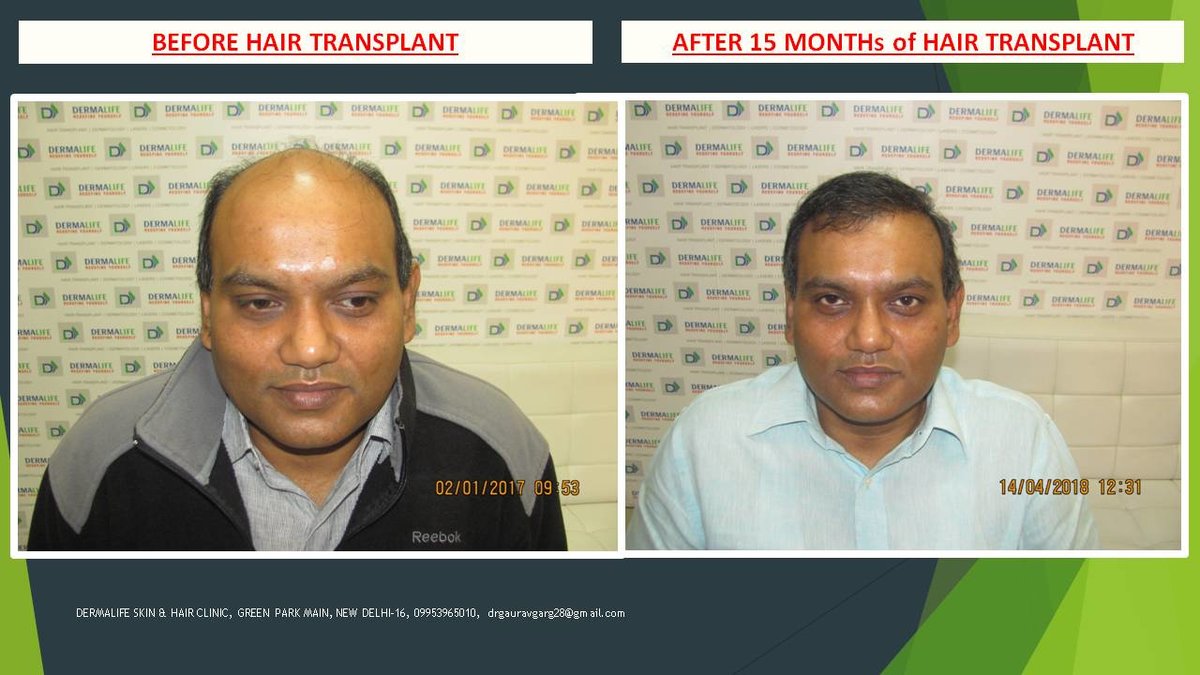 Dermalife Skin and Hair Clinic - Dermalife Skin and Hair Clinic