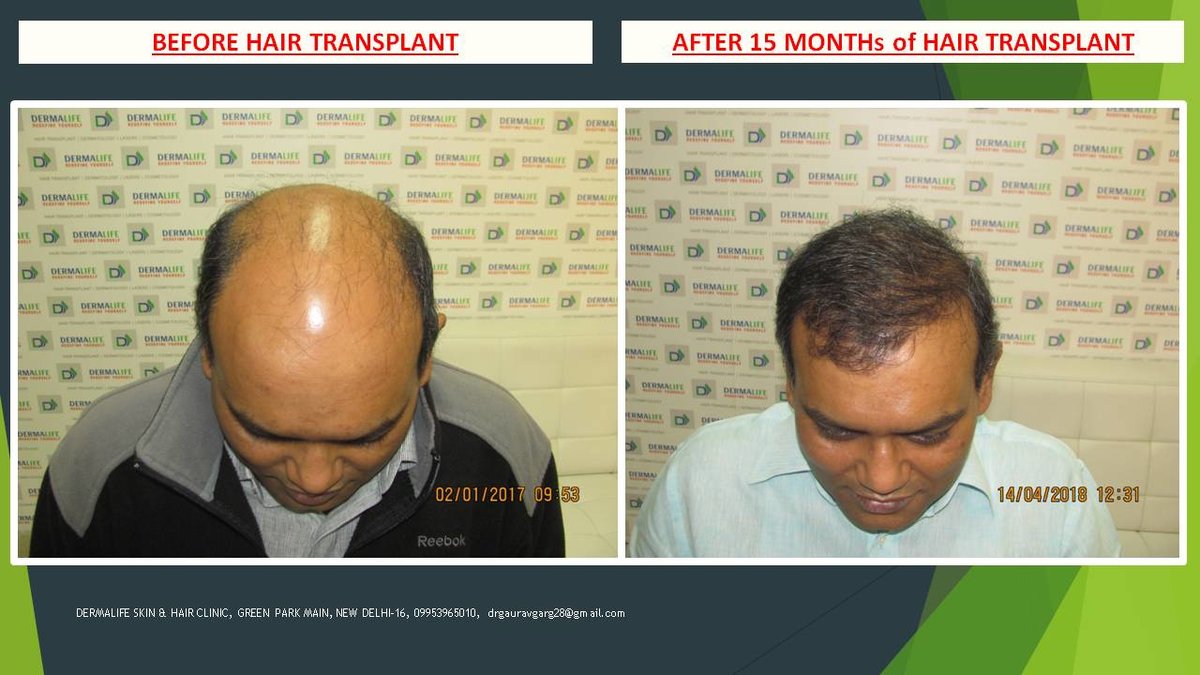 Dermalife Skin and Hair Clinic - Dermalife Skin and Hair Clinic