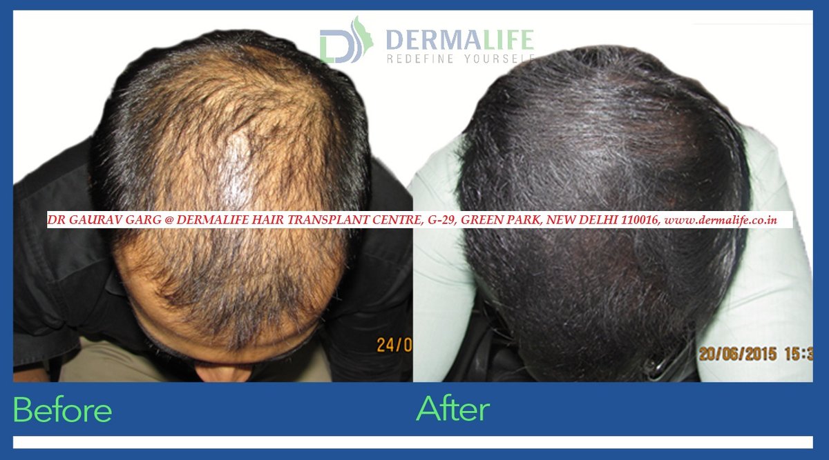 Dermalife Skin and Hair Clinic - Dermalife Skin and Hair Clinic