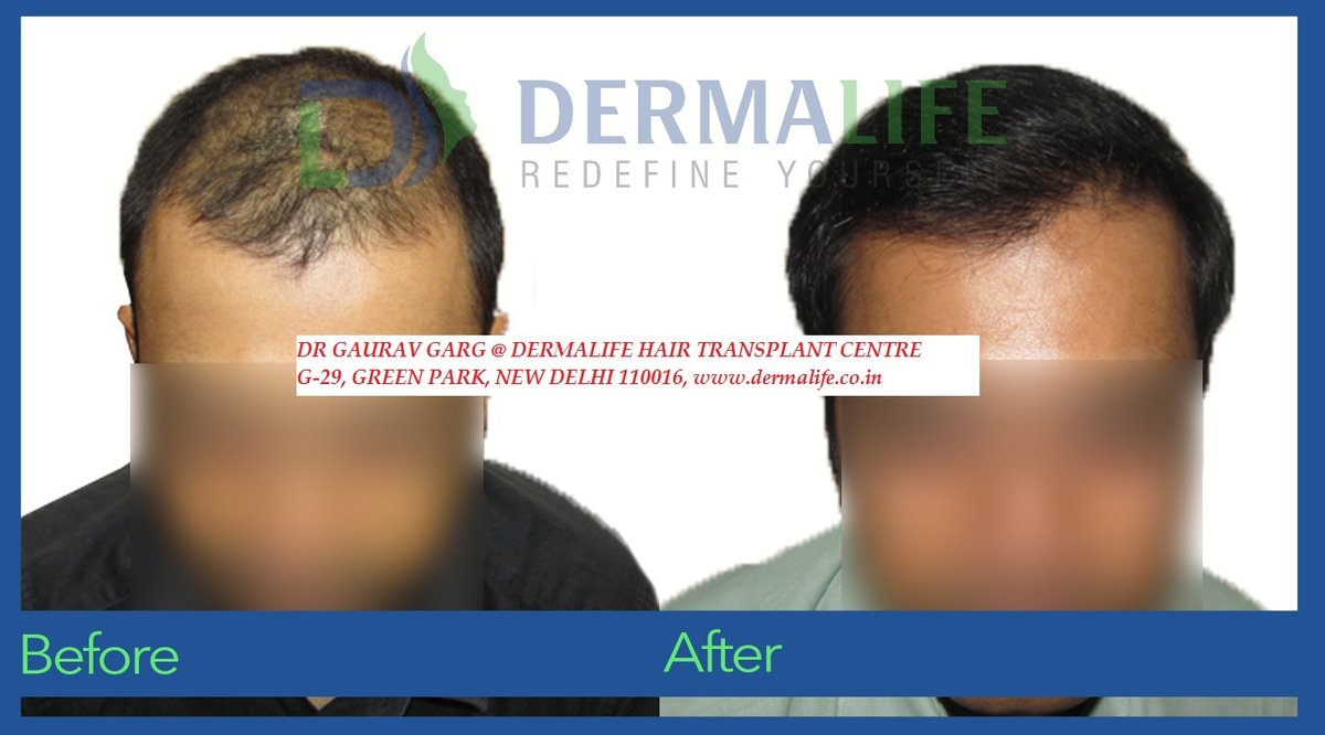 Dermalife Skin and Hair Clinic - Dermalife Skin and Hair Clinic