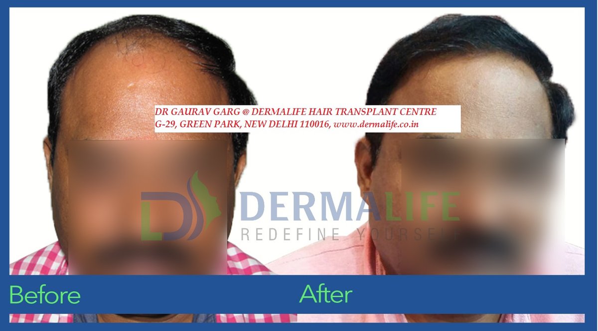 Dermalife Skin and Hair Clinic - Dermalife Skin and Hair Clinic