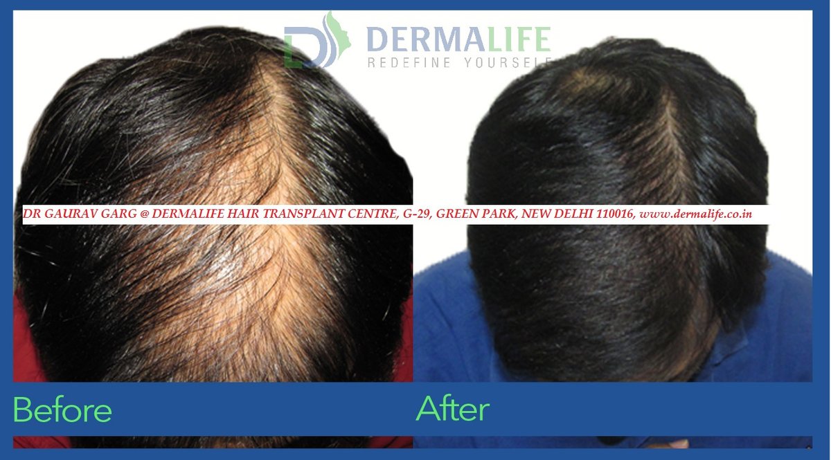 Dermalife Skin and Hair Clinic - Dermalife Skin and Hair Clinic