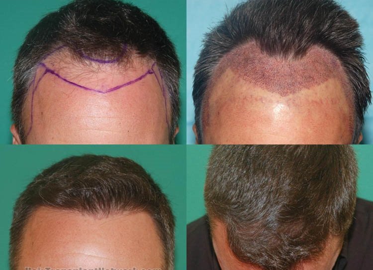 Dermasculpt Skin and Hair Clinic - Dermasculpt Skin and Hair Clinic