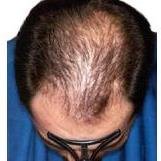 Dermatologische Praxis and Haarcenter Professor Trüeb - Dermatologische Praxis and Haarcenter Professor Trüeb